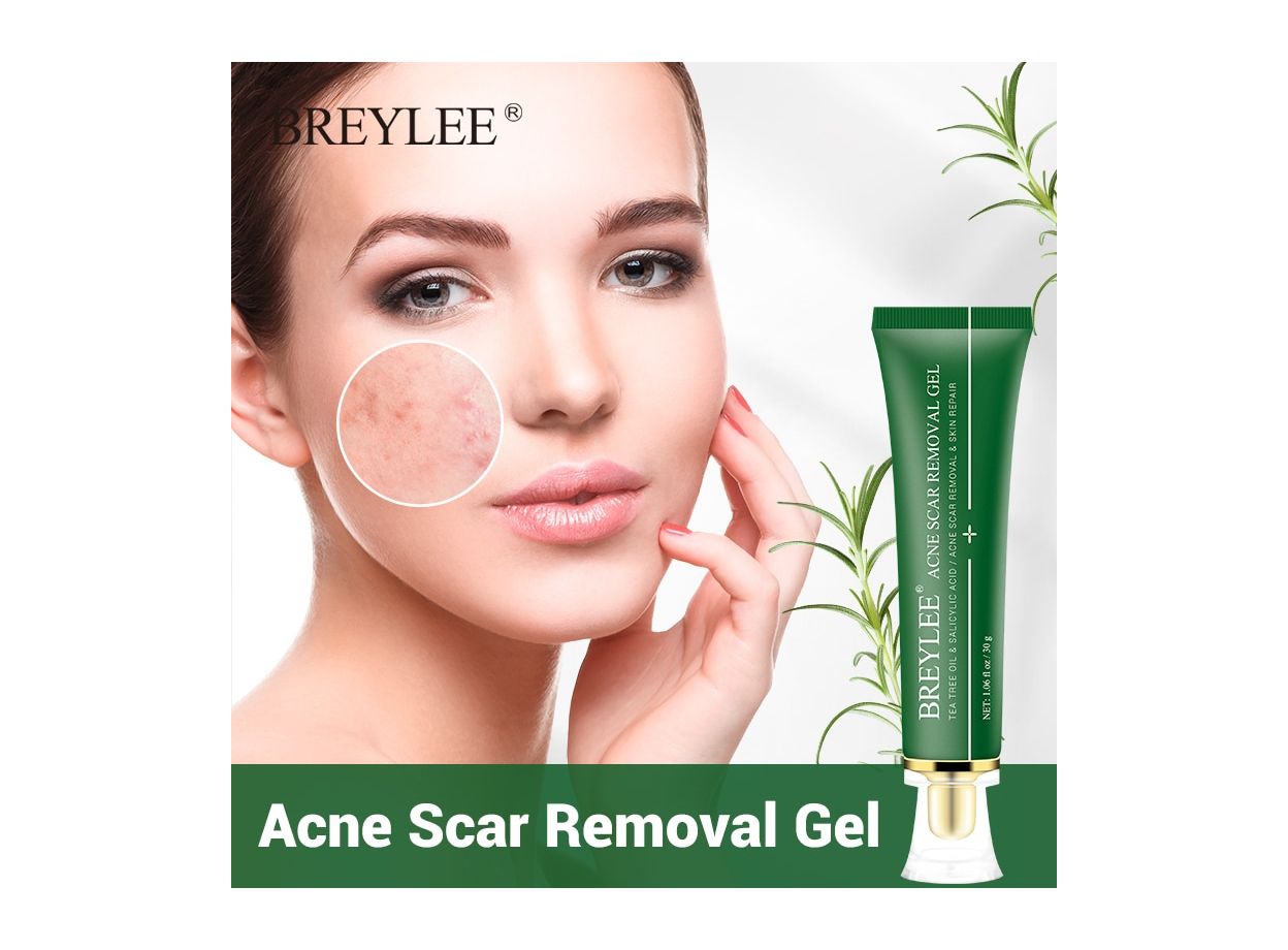 BREYLEE Acne Scar Removal Gel Fade Acne Marks Spots Remove Skin
