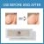 FOOT CARE MEDICAL PLASTER – CORN, CALLUS & PLANTAR WART REMOVAL PATCH