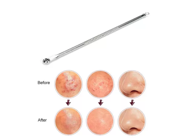 STAINLESS STEEL ACNE & BLACKHEAD EXTRACTOR TOOL – PROFESSIONAL FACE SKIN CARE REMOVER