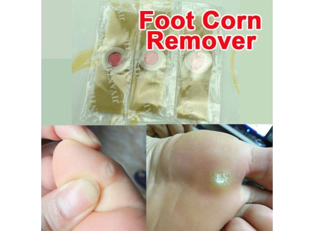 FOOT CARE MEDICAL PLASTER – CORN, CALLUS & PLANTAR WART REMOVAL PATCH