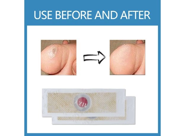 FOOT CARE MEDICAL PLASTER – CORN, CALLUS & PLANTAR WART REMOVAL PATCH