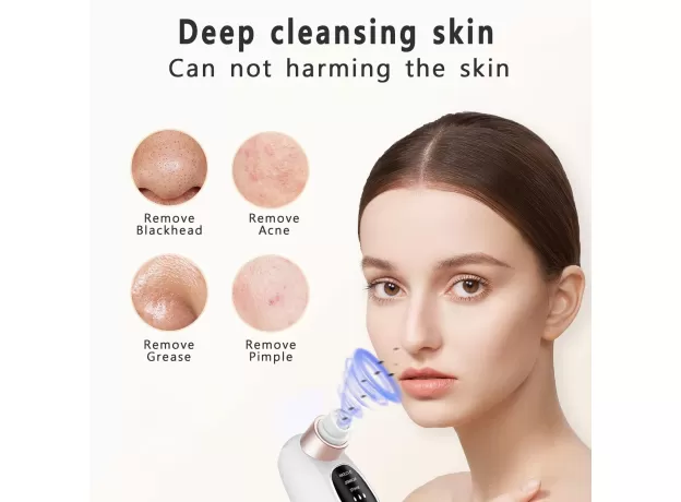 PROFESSIONAL PORE VACUUM CLEANER & BLACKHEAD REMOVER - 5 SUCTION LEVELS & 4 PROBES