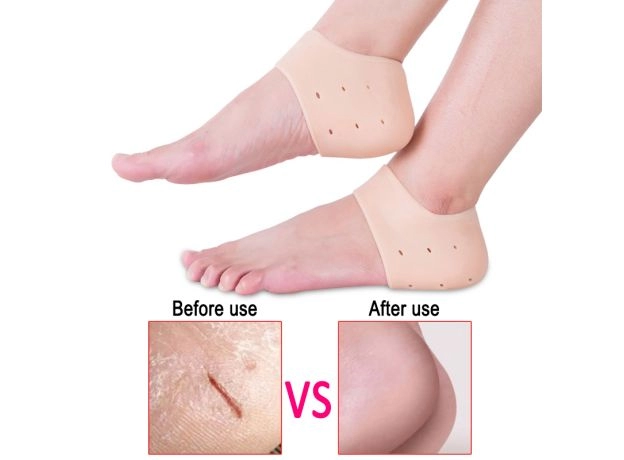 : SILICONE MOISTURIZING GEL HEEL SOCKS - CRACKED FOOT SKIN CARE | PROTECHSHOP