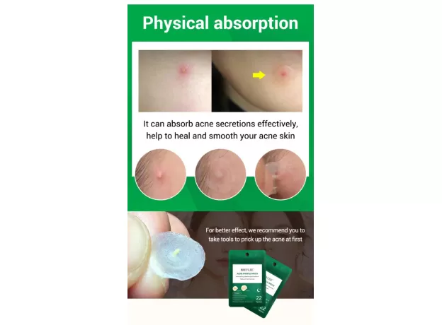 ACNE PIMPLE PATCH ACNE TREATMENT STICKERS PIMPLE REMOVER TOOL BLEMISH TREATMENT SKIN CARE FACIAL MASK