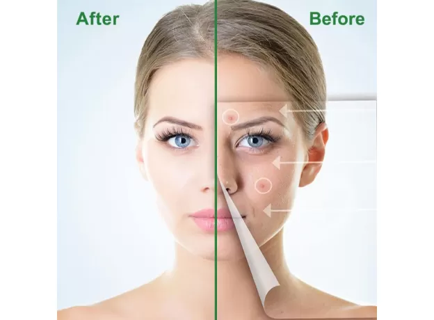 EFFECTIVE PIMPLE MASTER PATCH FACIAL SPOT SCAR CARE  ACNE INVISIBLE STICKER