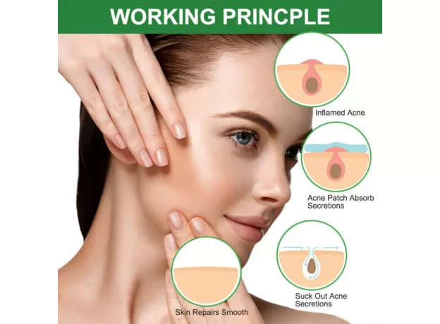 EFFECTIVE PIMPLE MASTER PATCH FACIAL SPOT SCAR CARE  ACNE INVISIBLE STICKER