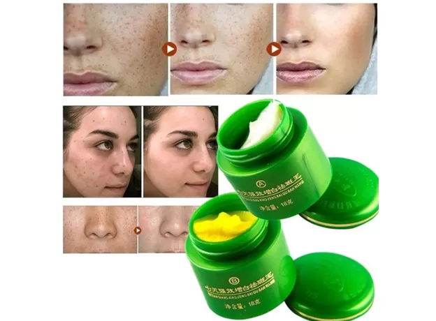 2PCS/SET FACE WHITENING CREAM BRIGHTENING FRECKLE DARK SPOT CORRECTOR REMOVAL FADE