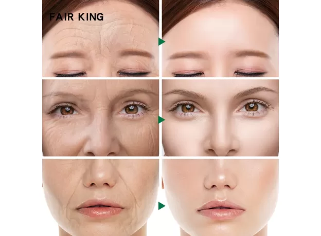 TEA TREE SNAIL FACE CREAM HYALURONIC ACID MOISTURIZER WHITENING ANTI WRINKLE ANTI AGING SERUM